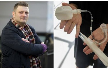 45-летний британец получил бионический пенис и смог впервые заняться сексом(6 фото + 1 гиф) 45-летний британец получил бионический пенис и смог впервые заняться сексом(6 фото + 1 гиф)