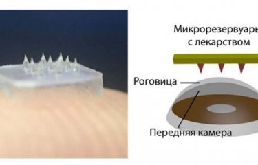 Новое слово в лечении глазных болезней — колючие контактные линзы(3 фото) Новое слово в лечении глазных болезней — колючие контактные линзы(3 фото)